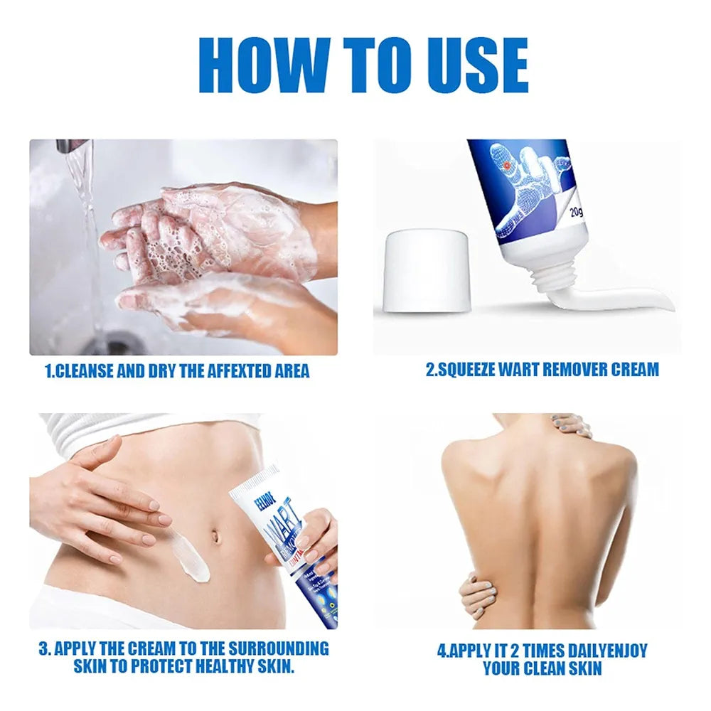 🌿 WartAway™ Herbal Removal Cream
