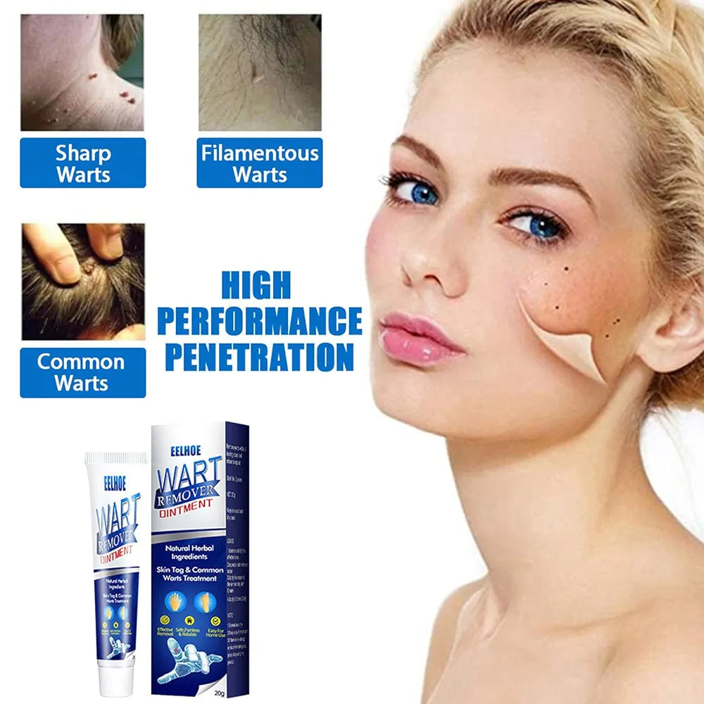 🌿 WartAway™ Herbal Removal Cream