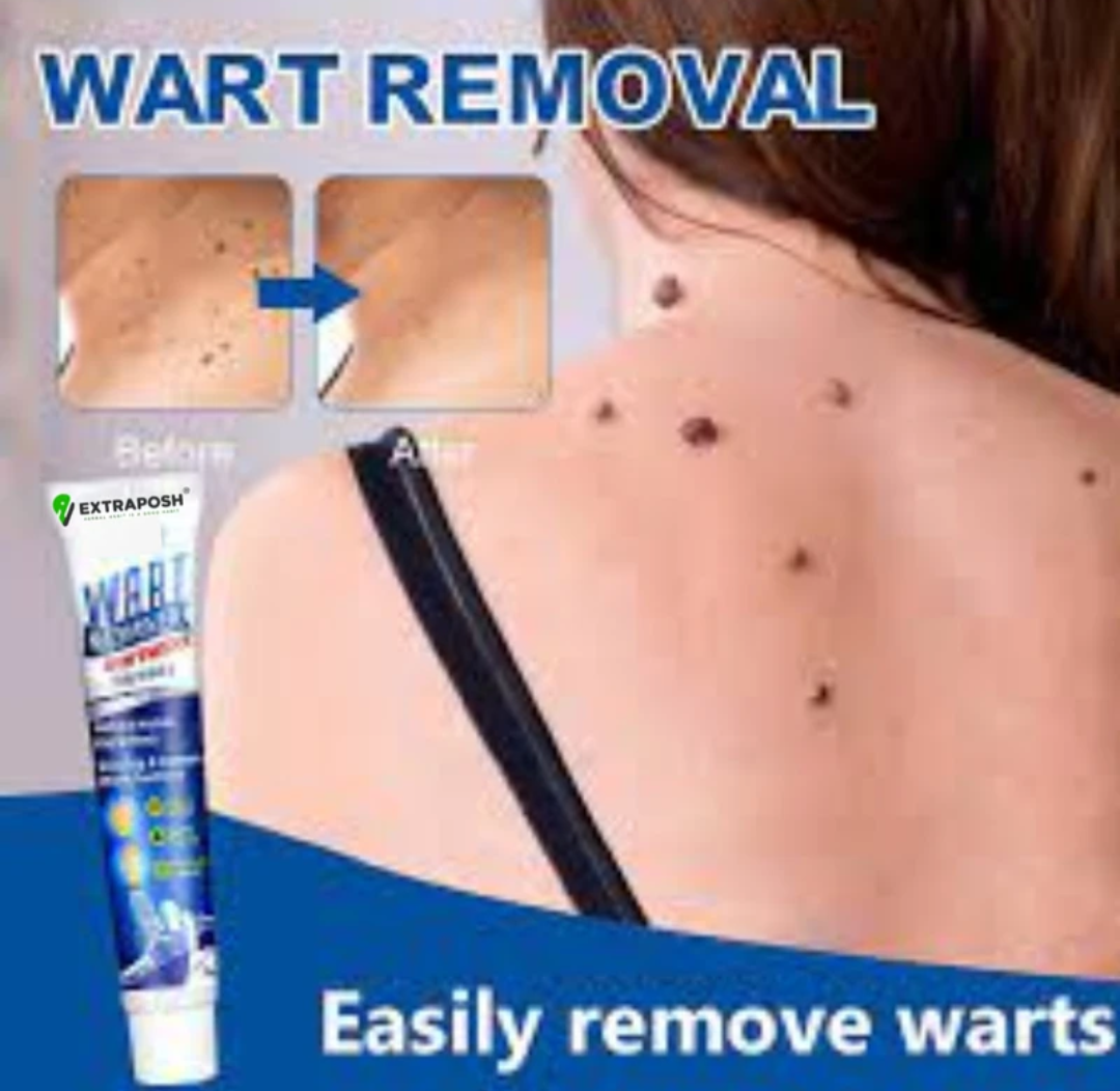 🌿 WartAway™ Herbal Removal Cream