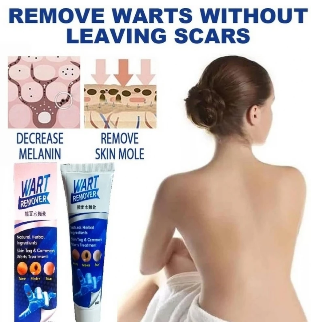 🌿 WartAway™ Herbal Removal Cream